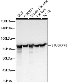 BiP/GRP78 Rabbit mAb
