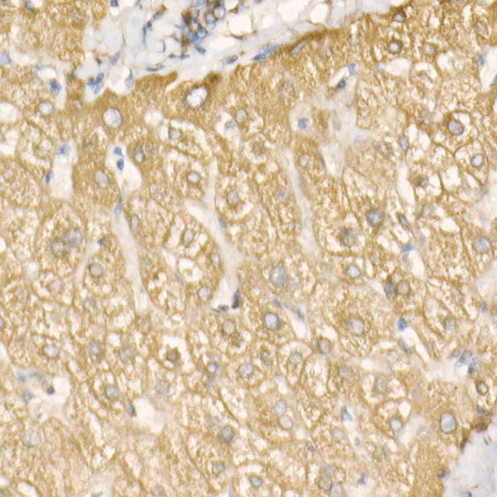 BiP/GRP78 Rabbit mAb