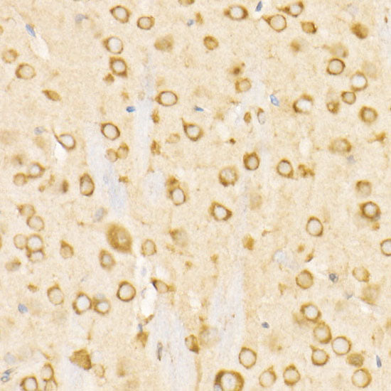 BiP/GRP78 Rabbit mAb