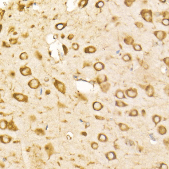 BiP/GRP78 Rabbit mAb