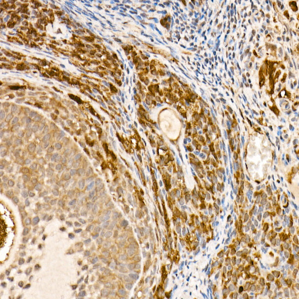 HSP70 Rabbit mAb