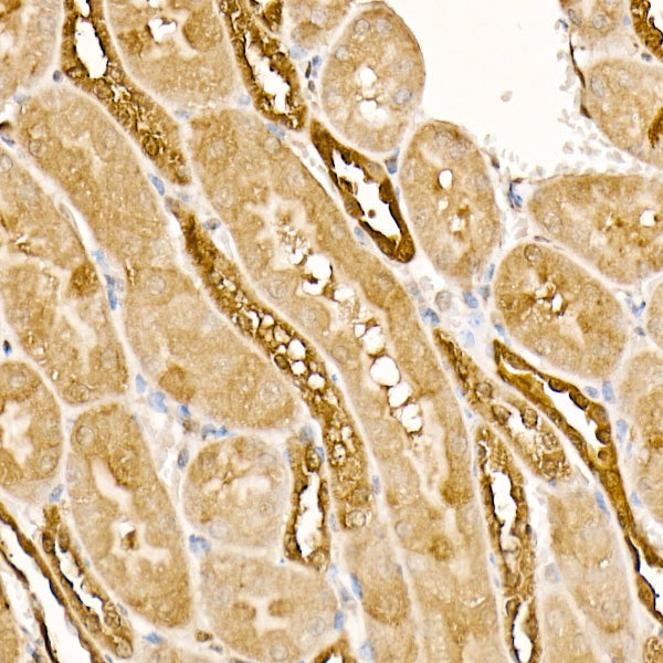 HSP70 Rabbit mAb