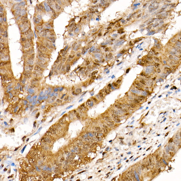 HSP70 Rabbit mAb