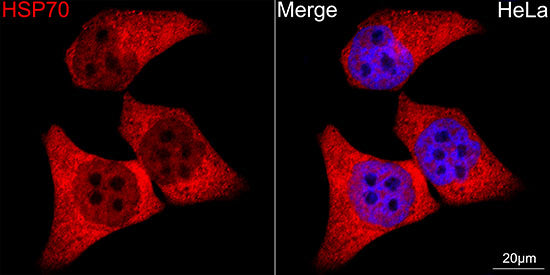 HSP70 Rabbit mAb