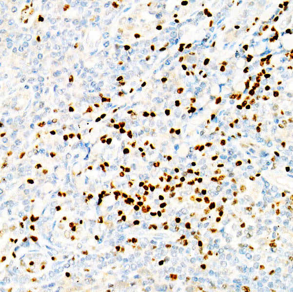 LEF1 Rabbit mAb