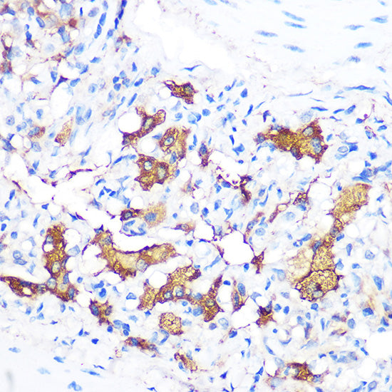 FGF21 Rabbit mAb