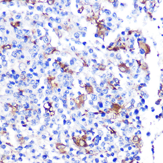 FGF21 Rabbit mAb