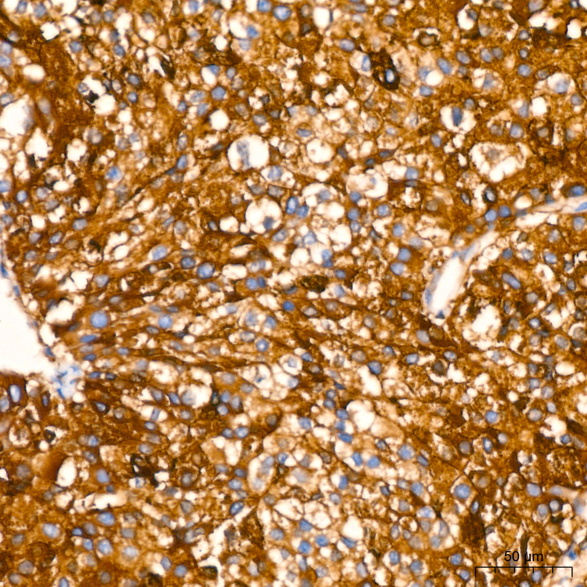 FGF21 Rabbit mAb