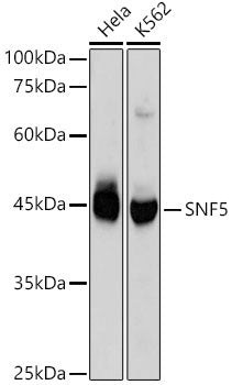 [KO Validated] SMARCB1/SNF5 Rabbit mAb