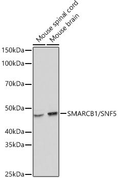 [KO Validated] SMARCB1/SNF5 Rabbit mAb