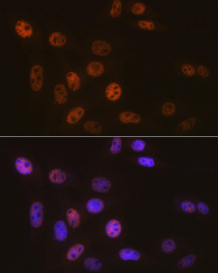 [KO Validated] SMARCB1/SNF5 Rabbit mAb