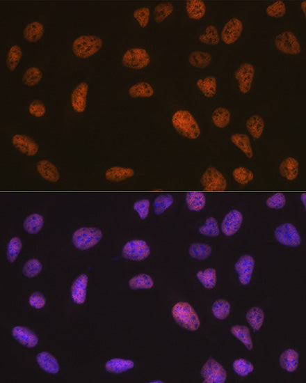 [KO Validated] SMARCB1/SNF5 Rabbit mAb