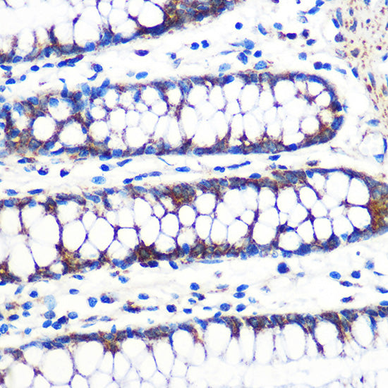 TFAM Rabbit mAb
