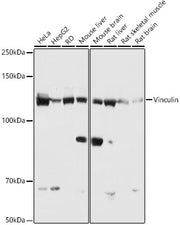 Vinculin Rabbit mAb