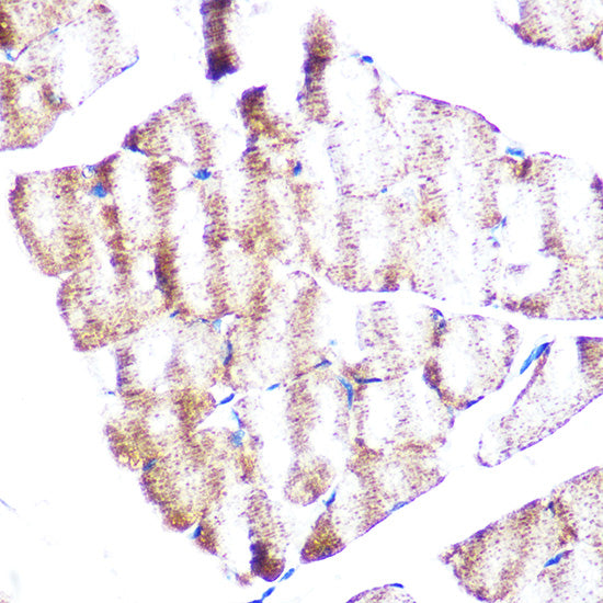 Vinculin Rabbit mAb