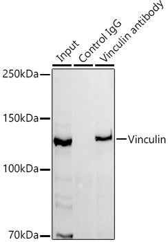 Vinculin Rabbit mAb
