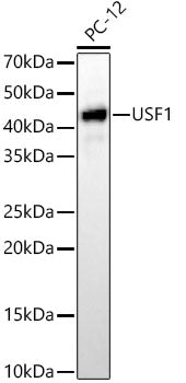 [KD Validated] USF1 Rabbit mAb