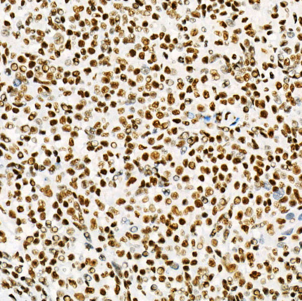 [KD Validated] USF1 Rabbit mAb