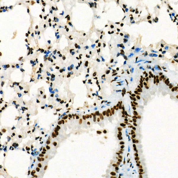 [KD Validated] USF1 Rabbit mAb