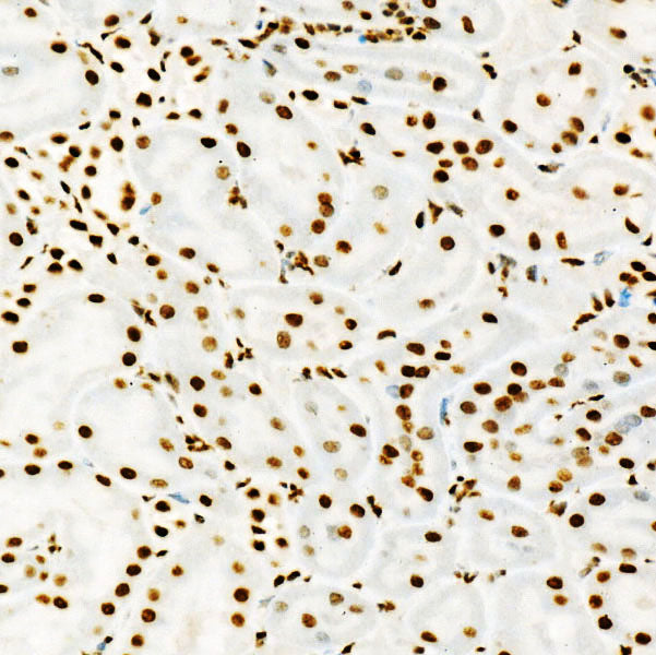 [KD Validated] USF1 Rabbit mAb