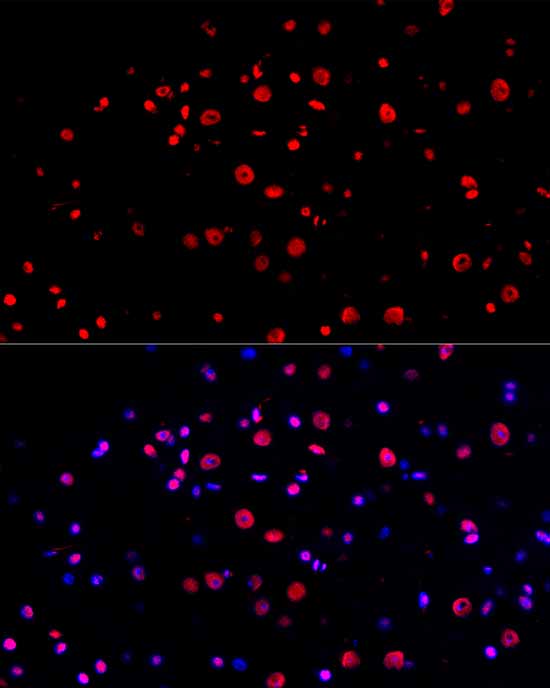 [KD Validated] USF1 Rabbit mAb