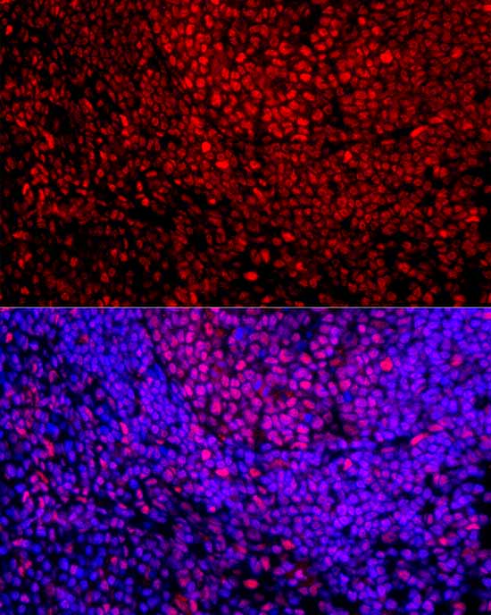 [KD Validated] USF1 Rabbit mAb