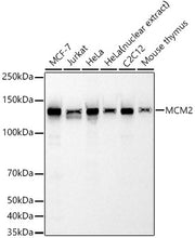 MCM2 Rabbit mAb