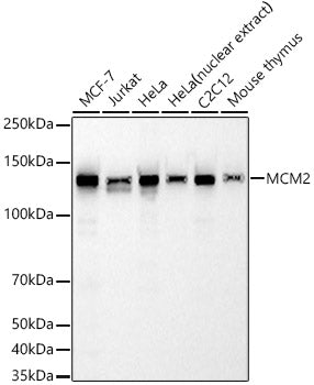 MCM2 Rabbit mAb