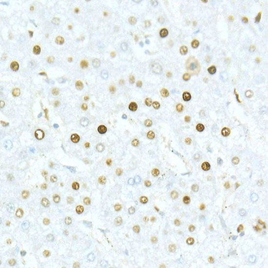 MCM2 Rabbit mAb