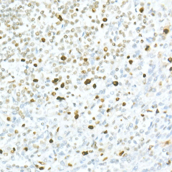 MCM2 Rabbit mAb