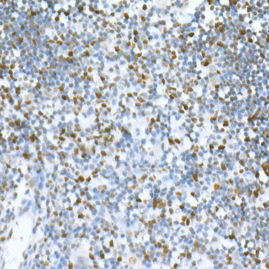 MCM2 Rabbit mAb