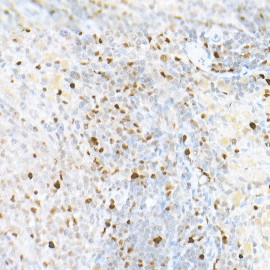 MCM2 Rabbit mAb