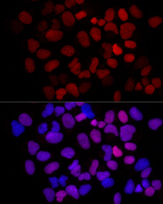 MCM2 Rabbit mAb