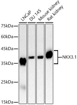 NKX3.1 Rabbit mAb