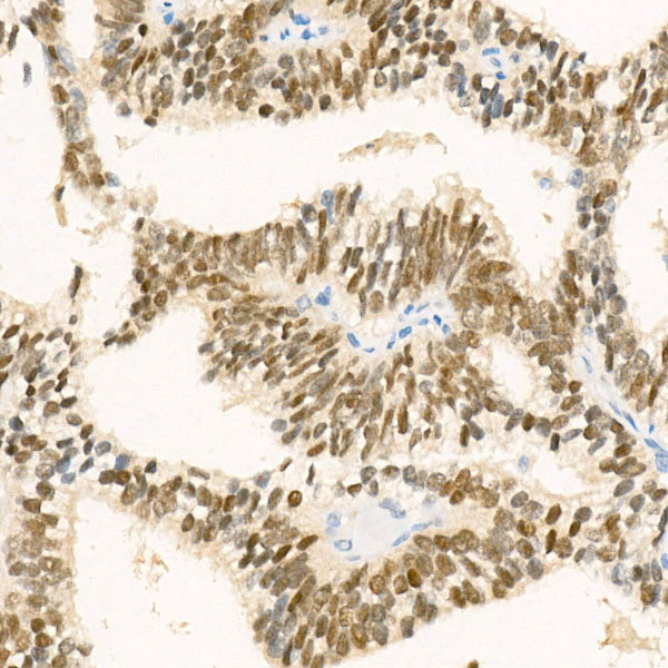 NKX3.1 Rabbit mAb
