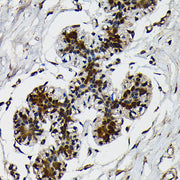 Ubiquitin Rabbit mAb