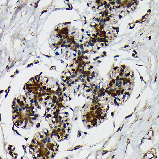Ubiquitin Rabbit mAb