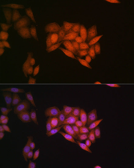 Ubiquitin Rabbit mAb