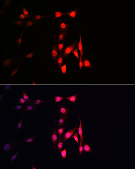 Ubiquitin Rabbit mAb