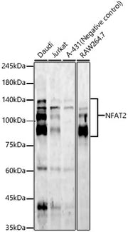 NFAT2 Rabbit mAb