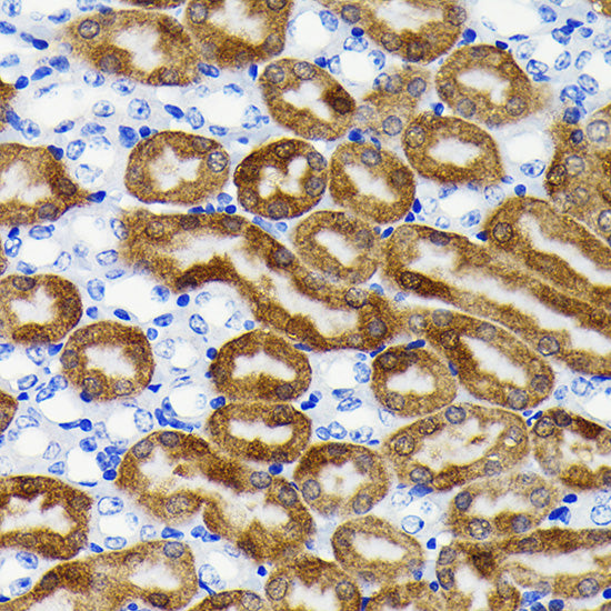 NQO1 Rabbit mAb