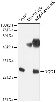 NQO1 Rabbit mAb