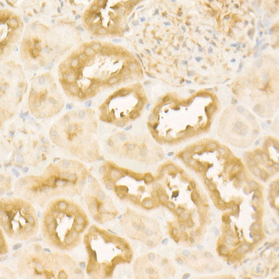 Hsp90β Rabbit mAb