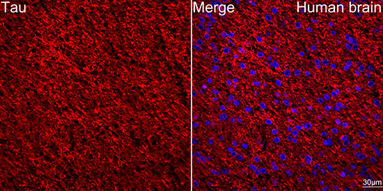 Tau Rabbit mAb
