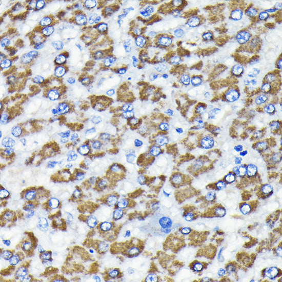 [KO Validated] Smad3 Rabbit mAb