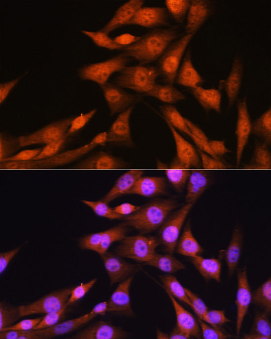 [KO Validated] Smad1 Rabbit mAb