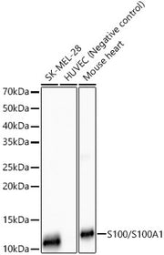 S100/S100A1 Rabbit mAb