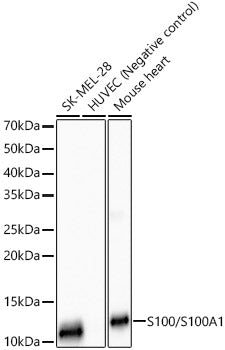 S100/S100A1 Rabbit mAb