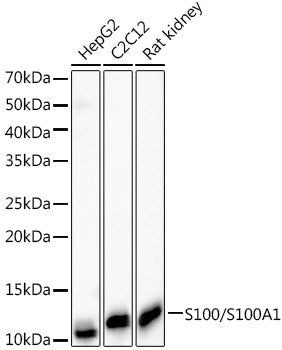 S100/S100A1 Rabbit mAb
