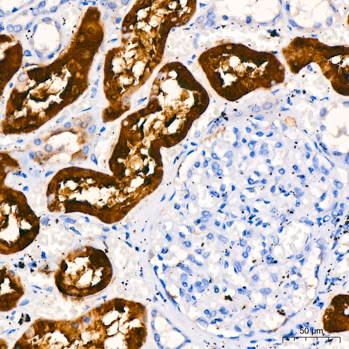 S100/S100A1 Rabbit mAb
